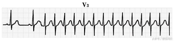 郭雅卿心电图讲解全集,郭雅卿心血管视频课