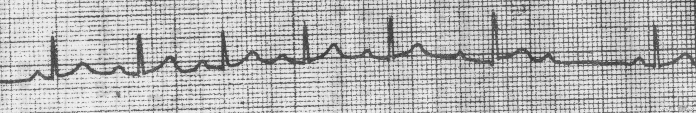 郭雅卿心电图讲解全集,郭雅卿心血管视频课