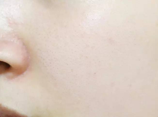 割双眼皮、垫鼻子、幽灵医生……一篇文章为你揭秘韩国整形