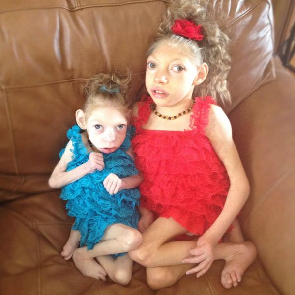 这位妈妈有两个患小头症的女儿，她家的画风是这样的