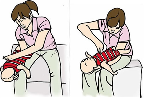 宝妈呛奶怎么处理,宝宝呛到气管的症状和急救方法