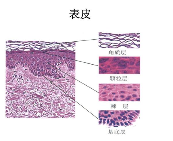 微针治痘坑涂碘伏,微针对深痘坑有效吗