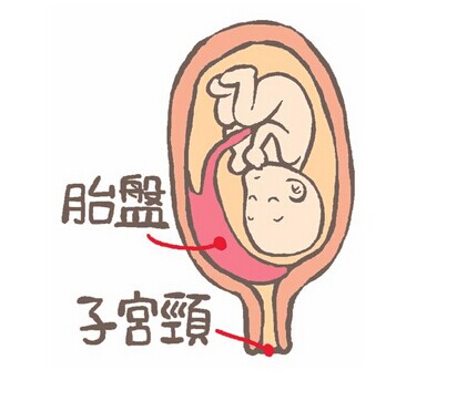 巧记分娩三大产程,简述分娩三个产程