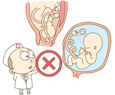 孕37周分娩,孕妇37周还有多长时间到预产期