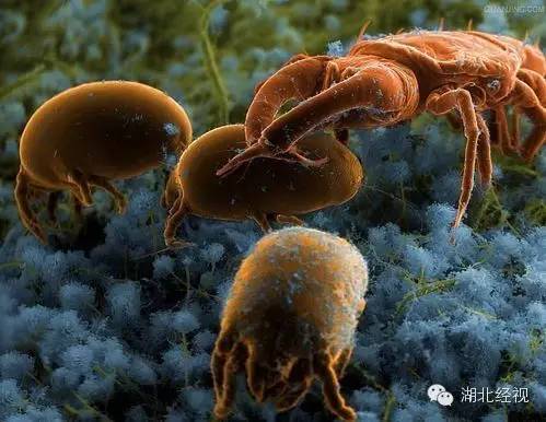 全身发痒是新冠吗怎么治疗,得新冠全身痒