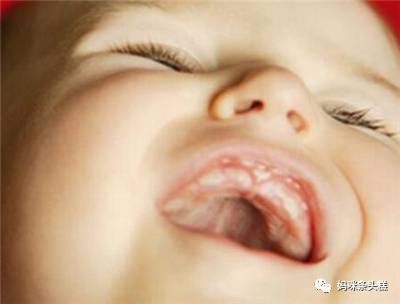 新生宝宝惊跳、抓耳挠脸、蜕皮，状况百出新手妈妈必备心理手册