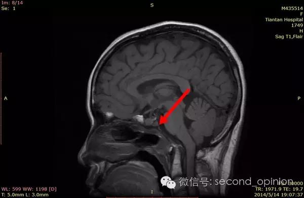 中国的质子中心有几家,全国有几所质子医院哪所最好