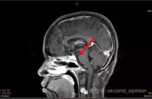 中国的质子中心有几家,全国有几所质子医院哪所最好
