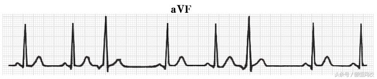 郭雅卿心电图讲解全集,郭雅卿心血管视频课