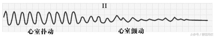 郭雅卿心电图讲解全集,郭雅卿心血管视频课