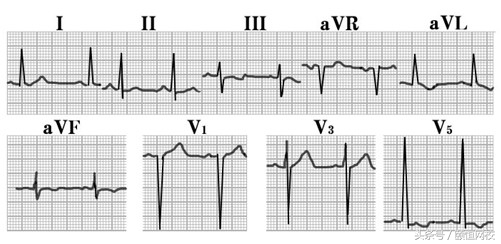 郭雅卿心电图讲解全集,郭雅卿心血管视频课