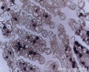 对虾养殖中常见的疾病,对虾白斑防治方法