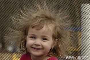 皮肤干燥产生静电让你的皮肤不再干燥远离静电