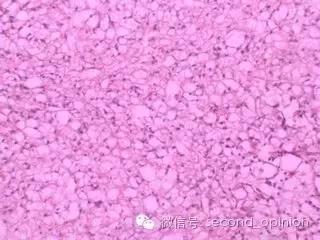 中国的质子中心有几家,全国有几所质子医院哪所最好