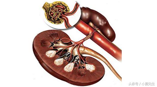 怀孕会导致肾病综合症吗,怀孕对肌酐有影响吗