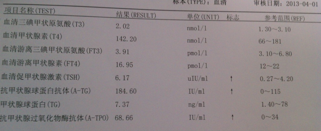 甲状腺功能减退报告单,甲状腺八项验血报告单怎么看