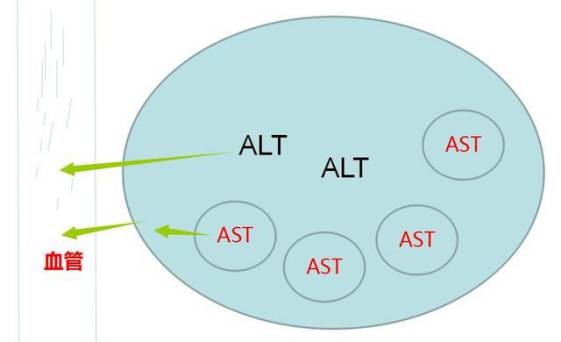 肝功能检查都正常就谷丙转氨酶高,谷丙转氨酶319.3谷草转氨酶152.6