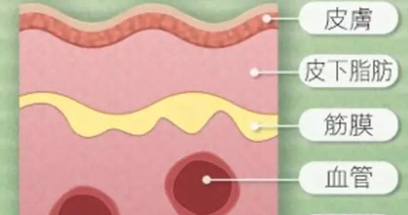 女性熬夜引发的病症,女性熬夜造成疾病