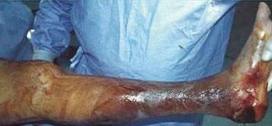 女性熬夜引发的病症,女性熬夜造成疾病