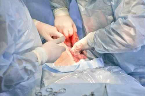 女人顺产和开刀哪个痛,女人生产产程短好还是产程长好