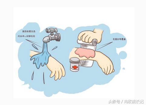 面对宝宝烫伤，亲们千万不慌，谨记宝宝烫伤的最佳处理时间
