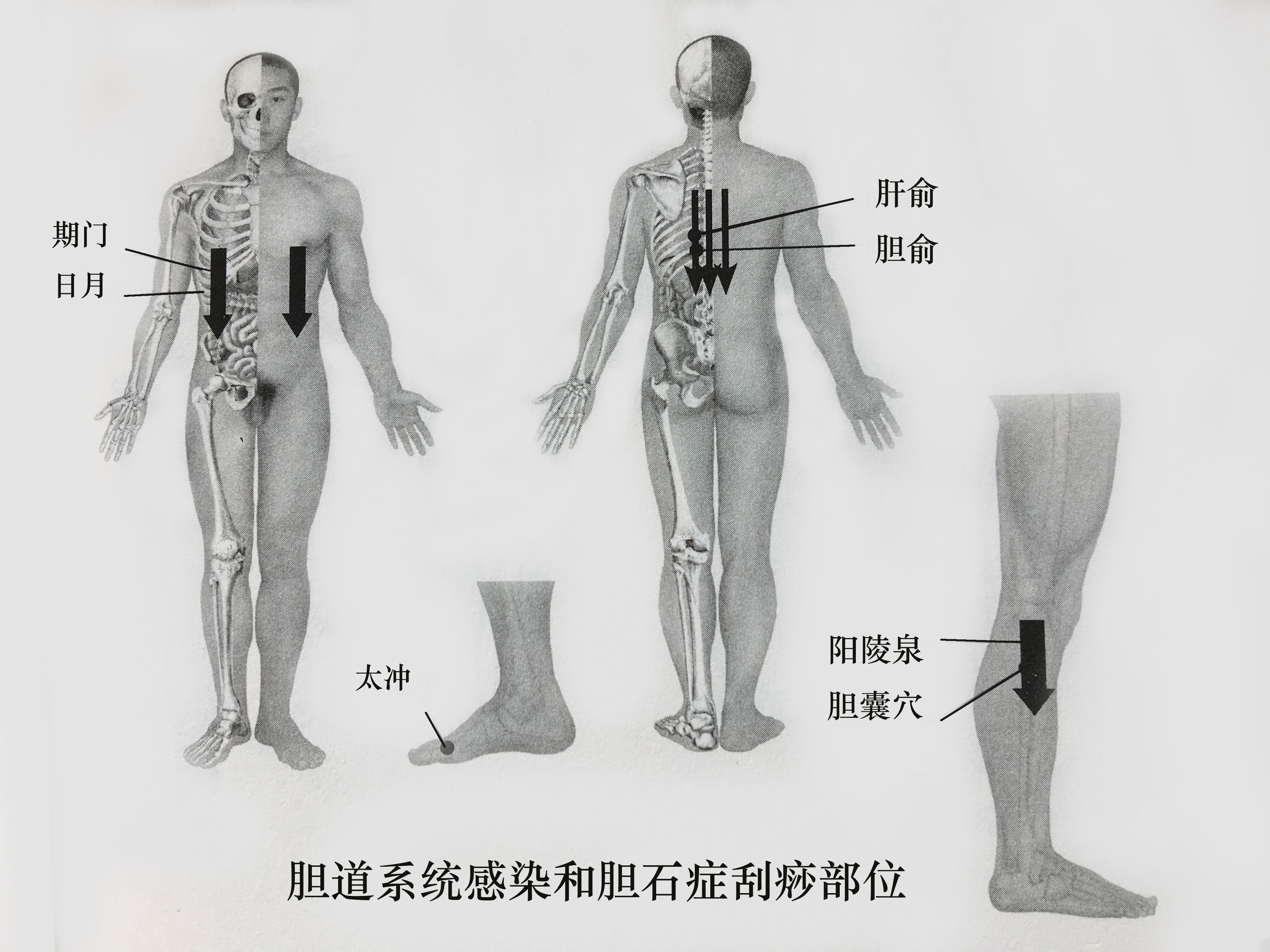胆囊炎胆结石可以吃什么药,胆囊炎伴胆结石最佳处理方案