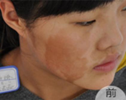 癌症母亲的最后心愿下集,绝症母亲最后的心愿齐琴