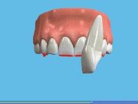 睡觉磨牙怎么办最好的方法,睡觉经常磨牙的原因及解决方法