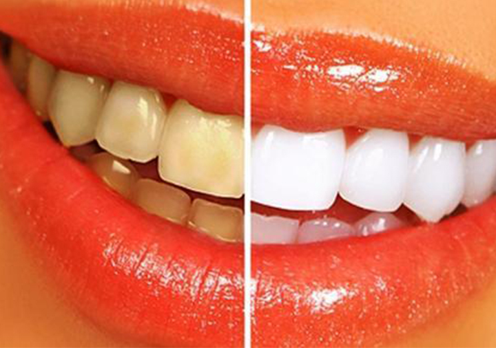 春节期间牙齿疼痛,春节过后口腔问题