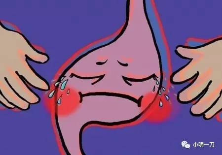 疾病每天学一点之胃痉挛