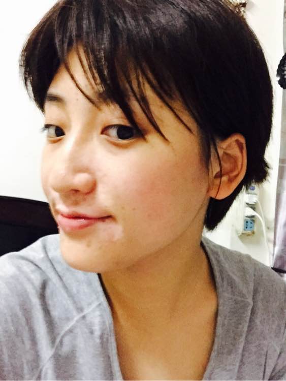 白斑光照,白斑光照后图片