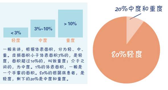 周主任讲解银屑病,银屑病健康宣教计划