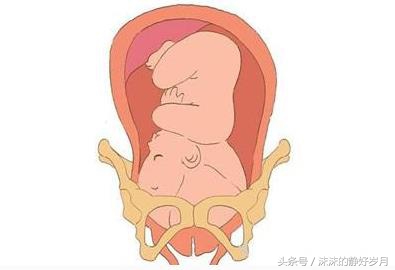 28周入盆后关注事项,孕妇三十七周已经入盆