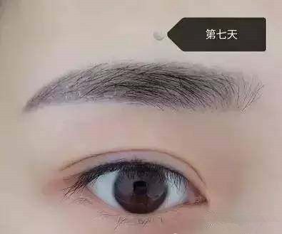 纹眉后恢复过程不要惊慌,男士纹眉恢复全过程图片