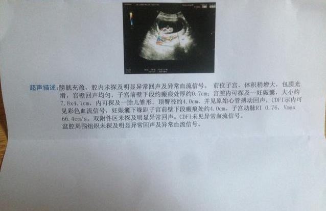 有两个女儿了想要儿子怎么办,2个女儿有必要再生一个吗