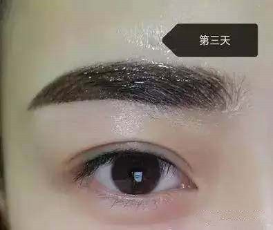 纹眉后恢复过程不要惊慌,男士纹眉恢复全过程图片