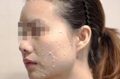 为什么去角质会搓出泥,去角质搓出来的是泥吗