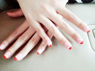 世界上有人为什么没有指纹,为什么人会留下指纹