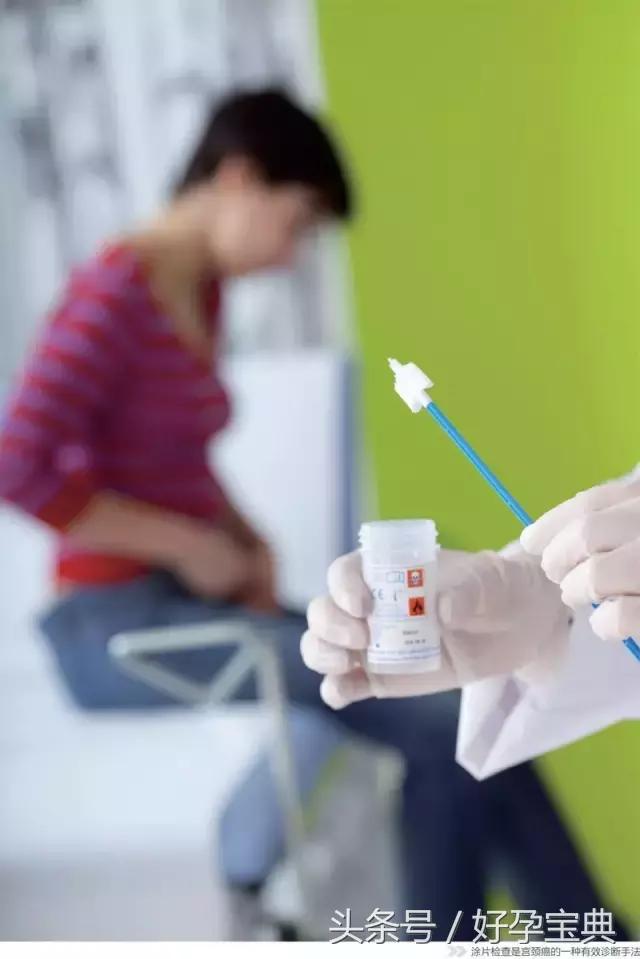 妇科检查前需要关注的事项,妇科支原体检查前要关注什么