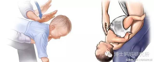 小孩误食抢救,小孩误食异物5天没有异样怎么办