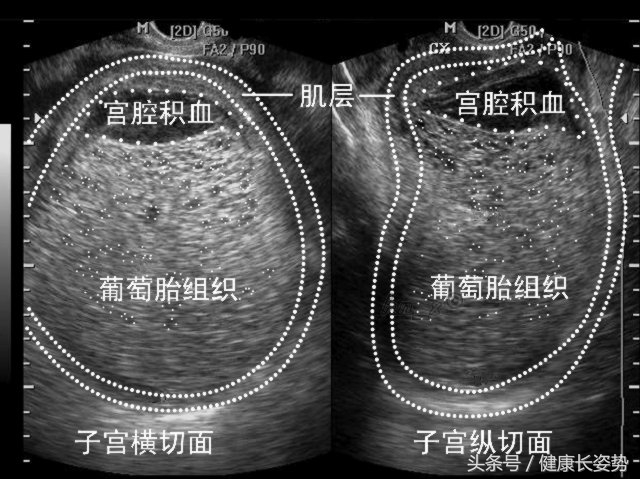 涨知识了但是记不住,涨知识剥洋葱不流泪