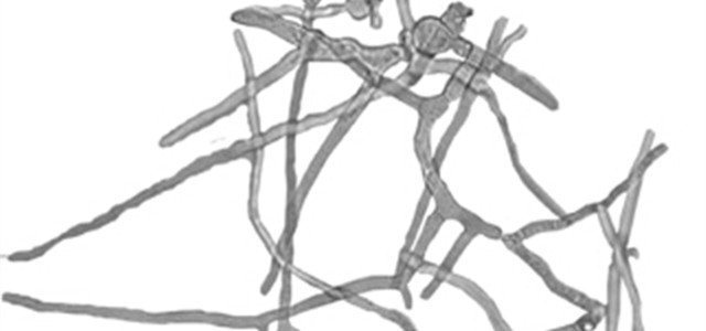 酸奶酵母菌的做法,制作酸奶要真菌还是细菌