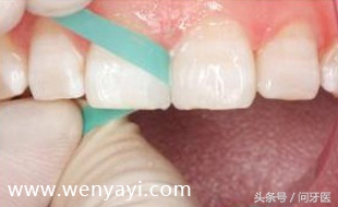 门牙有缝的女人有什么不好,门牙有缝怎么办