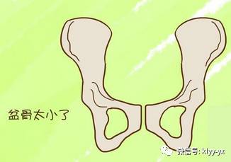 孕晚期骨盆测量一般怎么去测量,孕期骨盆如何测量