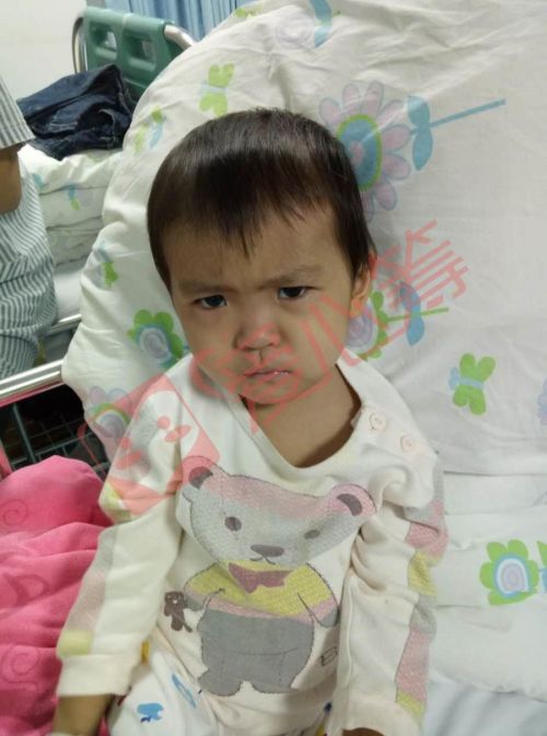 小儿粒细胞减少骨髓移植,宝宝粒细胞缺乏要做骨髓穿刺吗