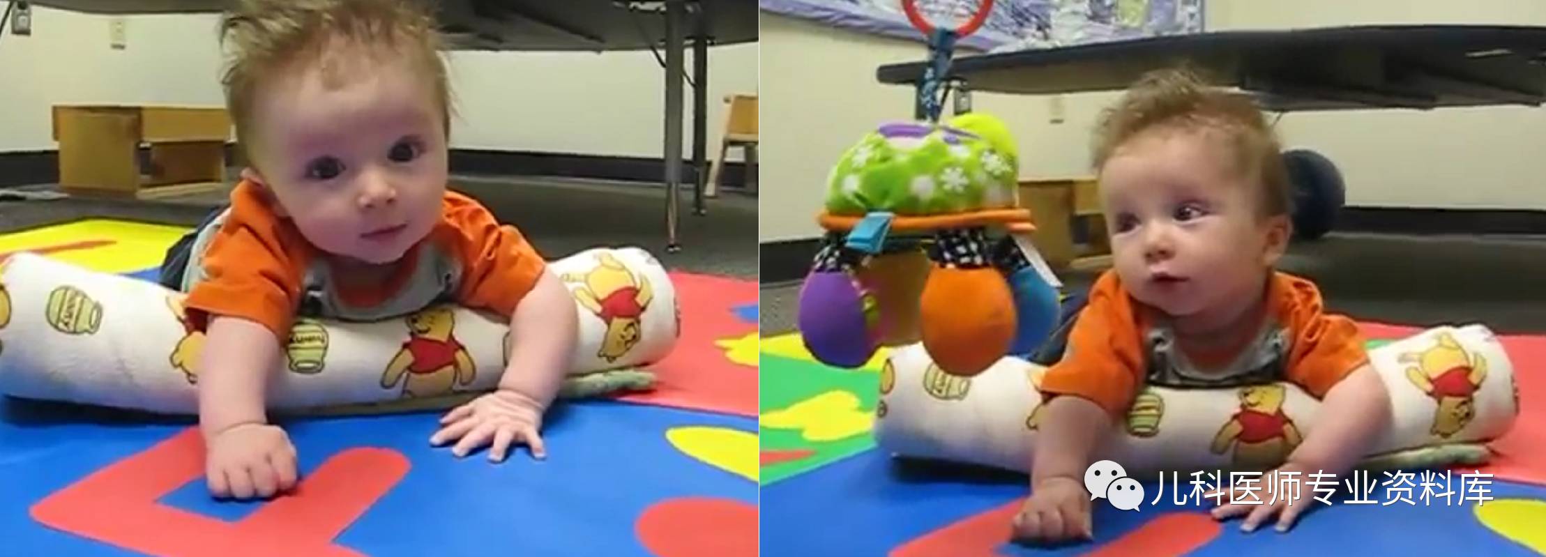 痉挛性斜颈患者说出了大秘密,痉挛性斜颈脖子歪照片