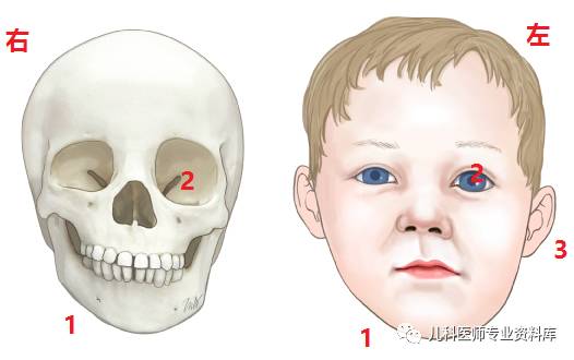 痉挛性斜颈患者说出了大秘密,痉挛性斜颈脖子歪照片