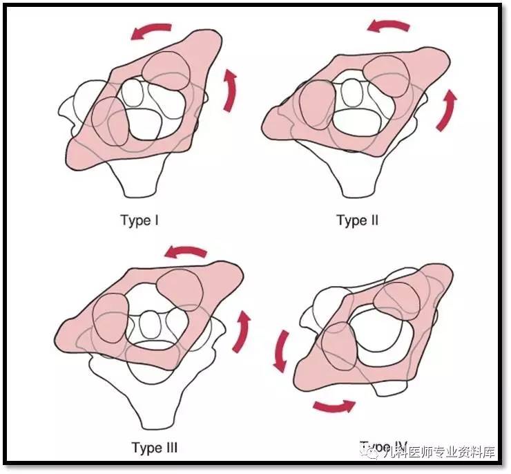 痉挛性斜颈患者说出了大秘密,痉挛性斜颈脖子歪照片