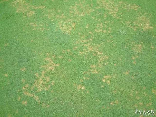 攻克黄斑病变,攻克白化病