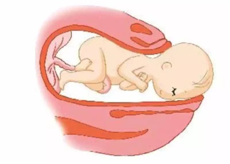 「科普」剖腹产的女明星那么多，为啥瘦小的“教主夫人”（杨颖）却能顺产？